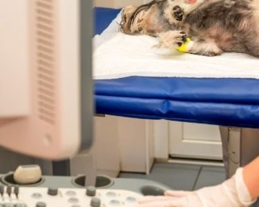 Ekokardiyografi Nedir